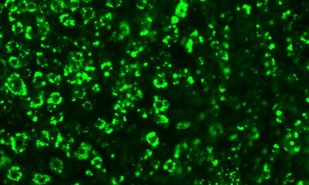 Tratamento para obesidade ganha impulso com microproteína Tratamento para obesidade ganha impulso com microproteína - Imagem do artigo original