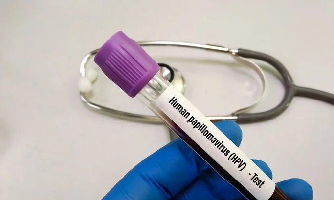 Exame HPV gratuito no SUS começa a ser oferecido Exame HPV gratuito no SUS começa a ser oferecido