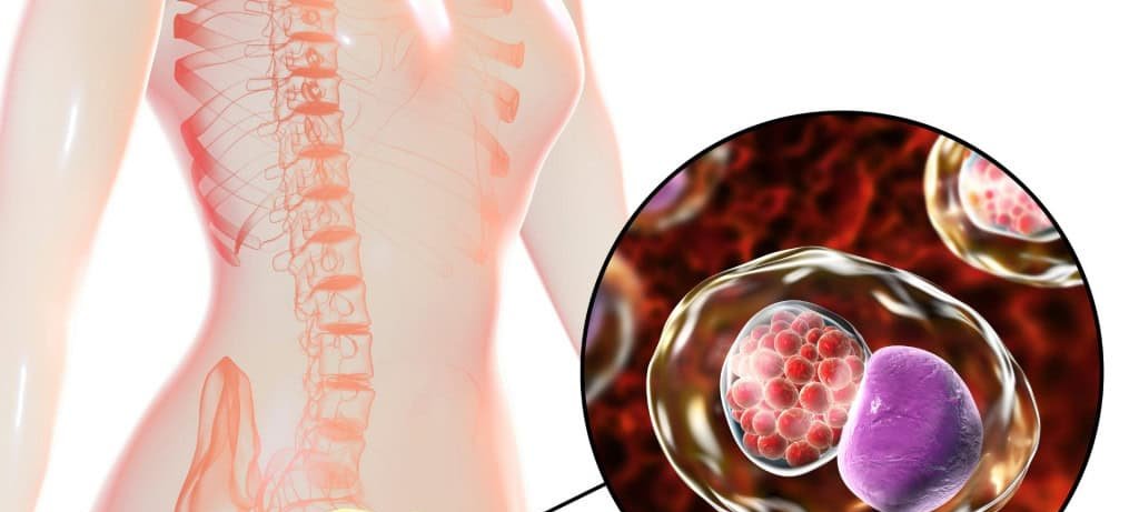 Doença Inflamatória Pélvica: riscos, sintomas e tratamento Doença Inflamatória Pélvica: riscos, sintomas e tratamento
