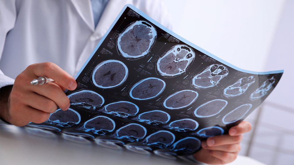 Neurotecnologia cresce e abre batalha pela protecção dos pensamentos Neurotecnologia cresce e abre batalha pela protecção dos pensamentos - Imagem do artigo original
