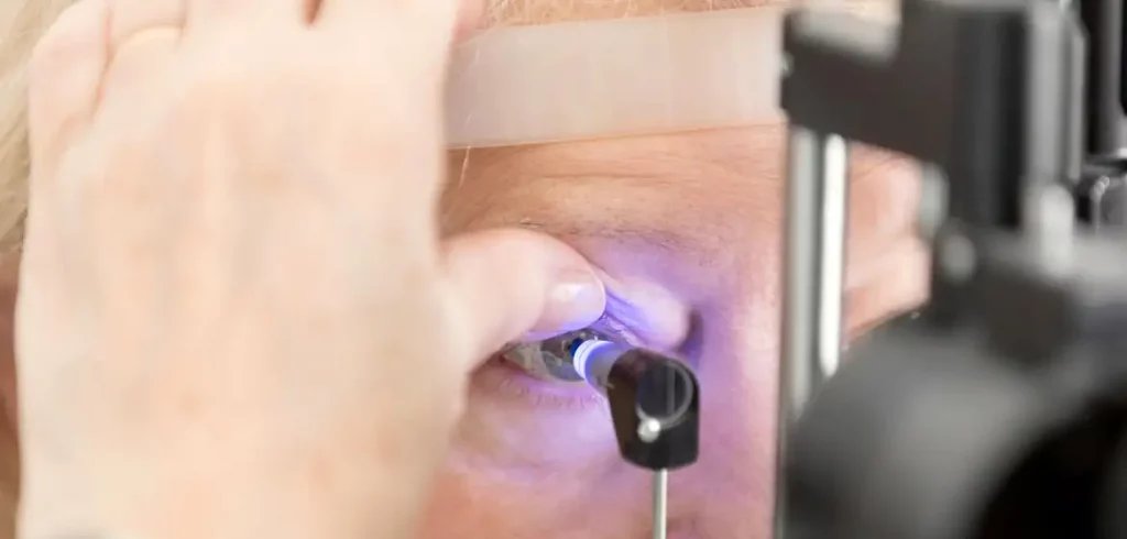 Brasil avança para eliminar tracoma com nova rede nacional de oftalmologistas Brasil avança para eliminar tracoma com nova rede nacional de oftalmologistas