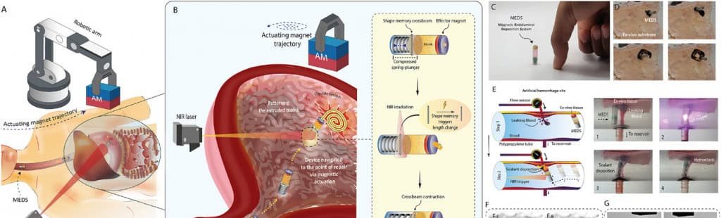 Bioimpressora em formato de cápsula promete tratamento não invasivo para lesões do trato gastrointestinal Bioimpressora em formato de cápsula promete tratamento não invasivo para lesões do trato gastrointestinal