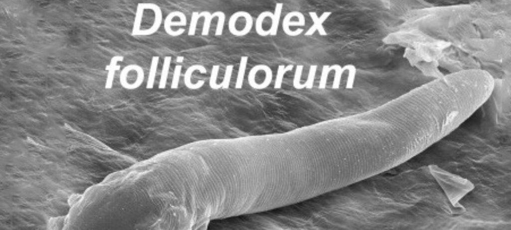 Oito microrganismos que habitam o corpo humano e por que eles importam Oito microrganismos que habitam o corpo humano e por que eles importam