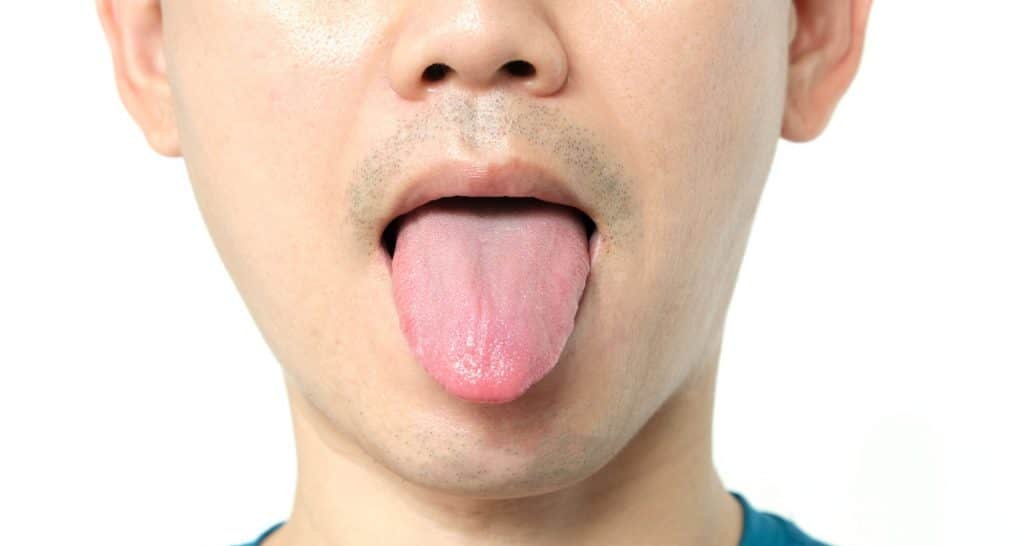 Língua revela sinais de doenças: o que cor, textura e formato indicam sobre a saúde Língua revela sinais de doenças: o que cor, textura e formato indicam sobre a saúde