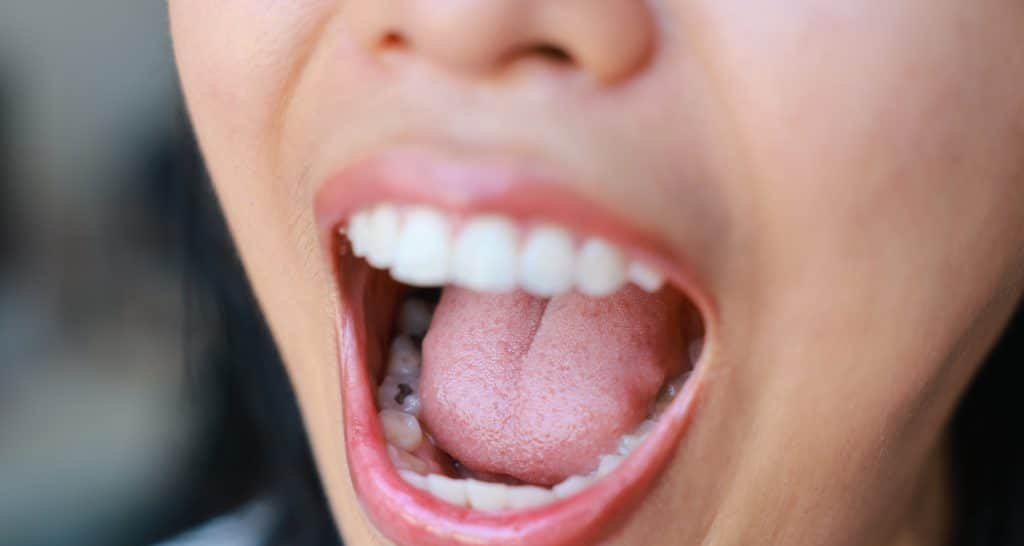 Gel biomimético abre caminho para regenerar o esmalte dentário e reduzir sensibilidade Gel biomimético abre caminho para regenerar o esmalte dentário e reduzir sensibilidade